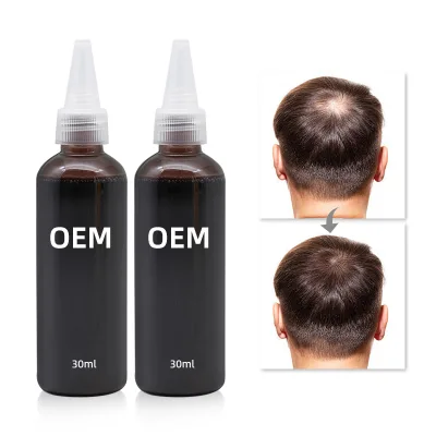 100ML  Liquid Hair Concealer for Scalp Coverage Top-Up Hair Loss Treatment for Body Popular in Barber Shops