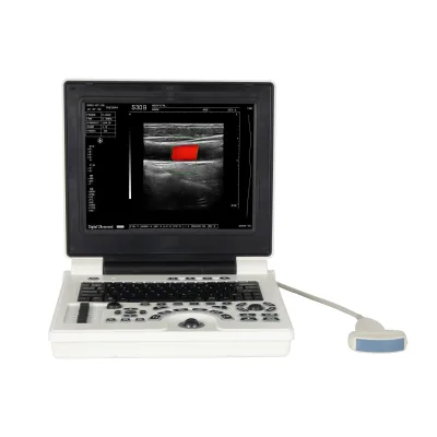 Medical Orthopedic Ultrasound Scanner 12 Inch Double Probe Baby Heartbeat Monitor Echocardiography Digital Laptop Color Doppler