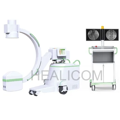 HCX-70B Hospital Medical Super High Power 12KW X Ray C-arm Machine With Workstation and Printer