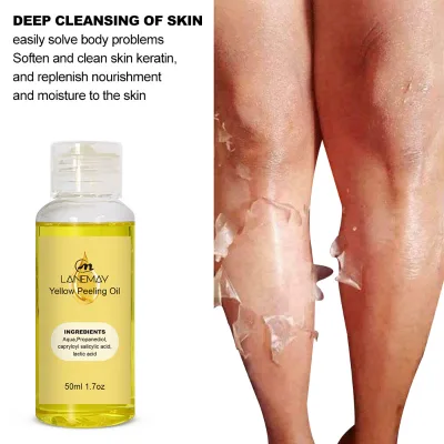 Small Quantity Customized Yellow Strong Peeling Oil for Dark Skin Extra Strength Exfoliating Peeling Solution for Body All Skin