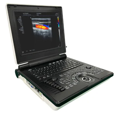 Reliable Medical Institutions and Hospitals Use Color Doppler Ultrasound System