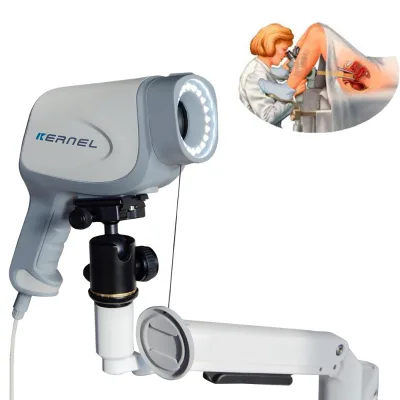 HD Screen COLPOSCOPE Digital Imaging System with High Definition Camera for Medical Optical Instruments