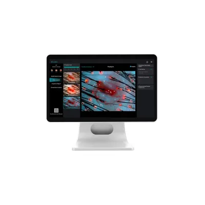 AI Technology Scalp Scanner Hair Loss Care 3 Spectrum Detection 10X 50X 100X 200X Probes