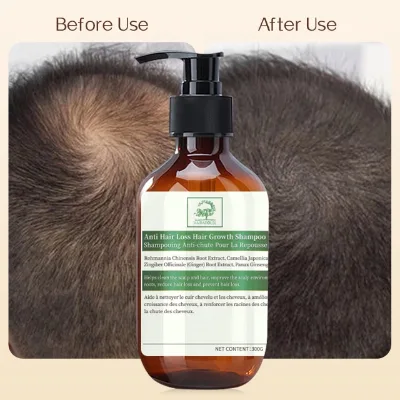 HAIR AROUSE Fast Hair Growth Products New Product Private Label Vegan Shampoo Organic 300ml Anti Hair Loss Shampoo