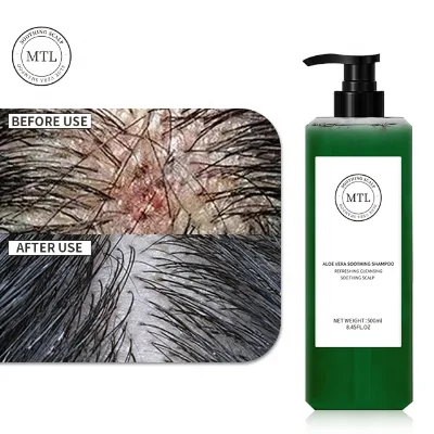 Free Sample Aloe Vera Shampoo Wholesale Custom Your Logo Paraben Free Herbal Sensitive Scalp Shampoo Soothing Aloe Hair Shampoo