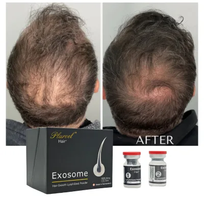 10 Billion Exosome Peptide Scalp Serum 20mg 5ml for Skin Repair