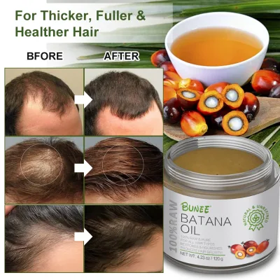 Private Label Batana Oil Pure Organic Batana Oil Wholesale Anti Loss Luxury Hair Regrowth Batana Oil
