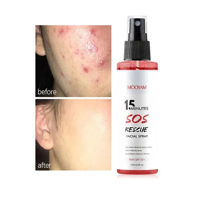 Private Label Anti Redness & Spider Vein Removal Spray Soothing SOS Daily Rescue Facial Spray