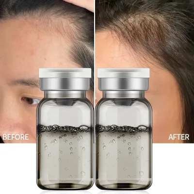 Nourishing Hair Capture Serum for Follicle Regeneration and Density Thickening Biotinoyl Tripeptide Hair Prevention Hair Regrowth Oil