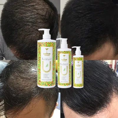 Private Design Vegan Organic Curly Hair Growth 3-in-1 Shampoo & Conditioner with Biotin Silicone Free