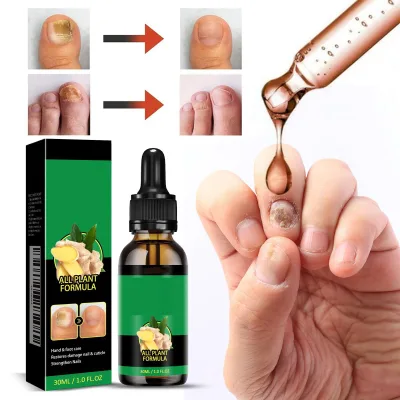 Nail Fungus Repair Liquid and Cuticle Oil Vitamins Supplement for Strengthening Damaged Cuticles and Nails for All Age Groups