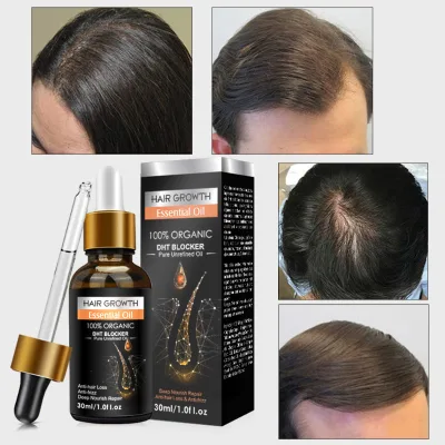 Private Label All Natural Formula Nourishing Scalp Rapid Hair Thickening Oil Organic Hair Oil Hair Growth Oil Serum