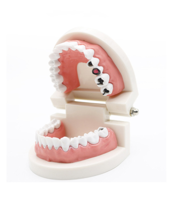 Good Price Standard 28 Teeth Plastic Dental Teaching Decay Practice Model
