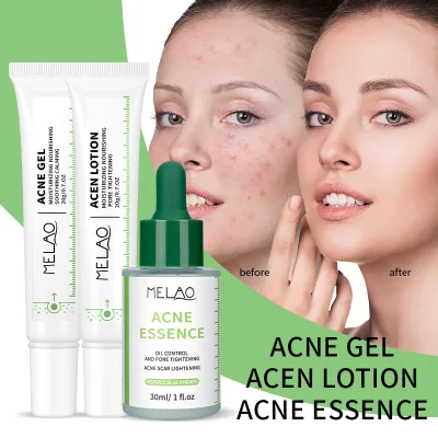 Premium Skin Care Serum Niacinamide Serum Face Care Lightweight Formula Skin Care Products Acne Serum