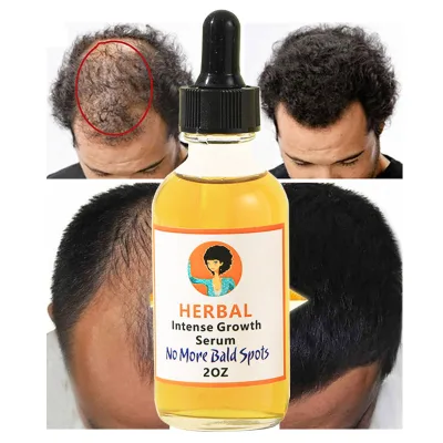 Hair Growth Oil Serum Hair Care Essence, Scalp Care Nutrient Liquid Hair Care Essential Oil