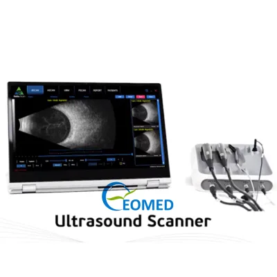 Professional Ophthalmic Hospital Use Pachymeter A-Scan B-Scan Scanner with UBM EUS-21