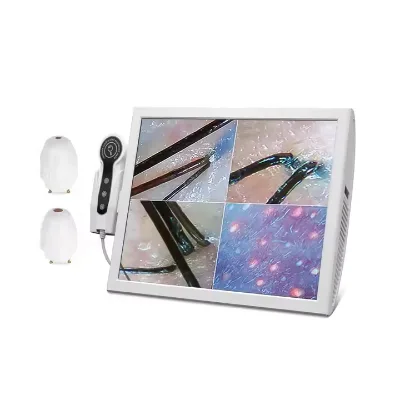 Portable HD Scalp Scanner Detector Home Use Hair Analyzer Machine for Skin and Hair Follicles Analysis Machine