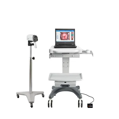EDAN C6HD Original HD Video Colposcope Digital Video Colposcopio Edan Colposcope Manufacturers