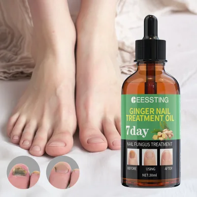 Custom Logo Organic Vegan Fast-Absorbing Essence Strengthening Nail Fungus Treatment Whitening Ginger Antibacterial Nail Oil