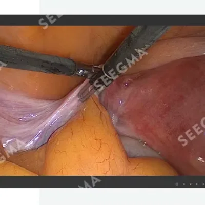 Ready to ship 27inch Endoscopic Surgical Display for Hospital Use