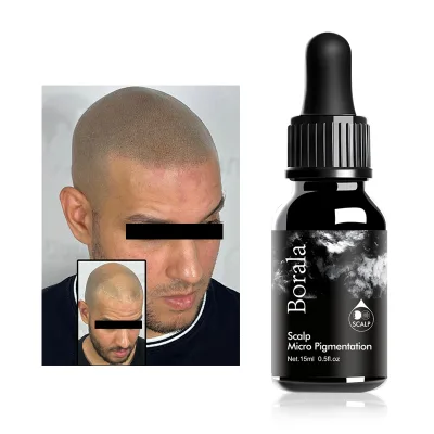 Hair Micropigmentation Dermograph for Microblading Pigment Scalpmicrotattoo