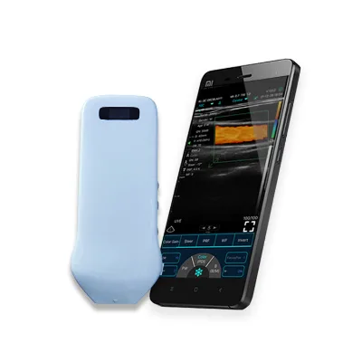 3 in 1 Handheld Ultrasound Handheld 14Mhz Linear Wifi Color Doppler Machine for Plastic Surgery & Vascular