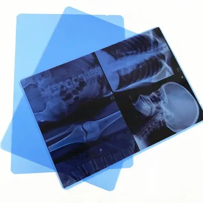 14*17inch Medical X-ray Dry Film for CT Scanning Sensitive Laser X-ray Films Blue Sensitive Digital Medical X-ray Film