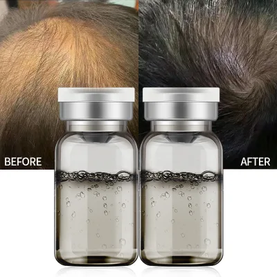 Hair Serum Solution Fast Growing Repair Treatment Hair Regrowth Organic Biotin Hair Growth Serum