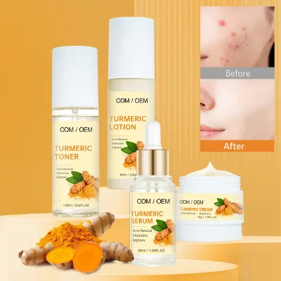 OEM Turmeric Skin Care Set Organic Natural Anti Acne Anti-aging Turmeric Facial Brightening Toner Turmeric Serum Skin Care Set