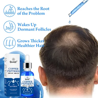 Professional Copper Peptide Hair Growth Serum with GHK Cu AHK Cu Thinning Hairline Regrowth Treatment Men Women OEM