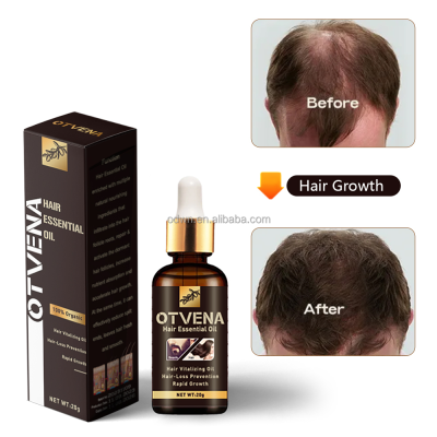Private Label Hair Care Customized Hair Growth Oil Natural Hair Loss Prevention Oil