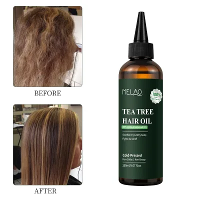 Formula Follicle Strengthening Root Nourishment Clarifying Care Lightweight Fast Absorbing Daily Scalp Care Tea Tree Hair Oil