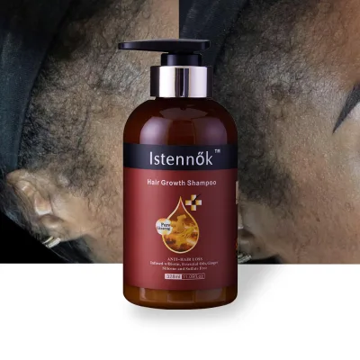 hair growth shampoo Revitalizing Shampoo with Tea Tree Oil, Eucalyptus, and Menthol to Refresh and Support Scalp Health