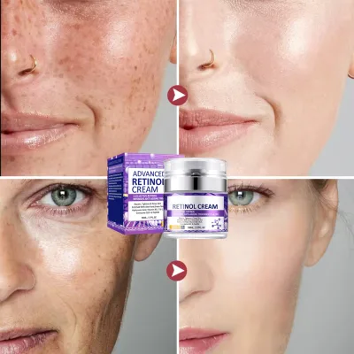 Hyaluronic Acid Facial Cream Nourishing Collagen Anti-aging Removal Winkles Fine Lines Retinol Face Cream