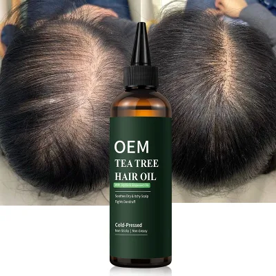 Natural Herbs Hair Oils Thinning Hairline India Hair Growth Oil Vitamin E Oil for Hair Growth