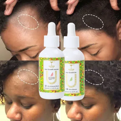Factory Price Private Label Rosemary and Avocado Hair Growth Oil Serum Natural Fast Hair Growing Castor Oils for Hair Growth
