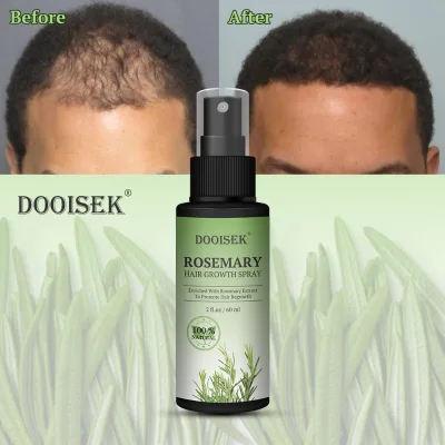 Dooisek Natural Rosemary Mint Oil Spray Anti Hair Loss Mist Hair Spray Product Repair Treatment Baldness Hair Growth Spray