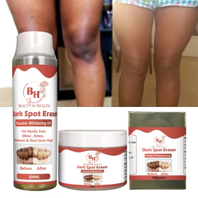 Hot Sell OEM Effective Knuckle Whitening Brightening Finger Elbow Neck Dark Spot Removal Knuckle Whitening Cream Oil Soap Set