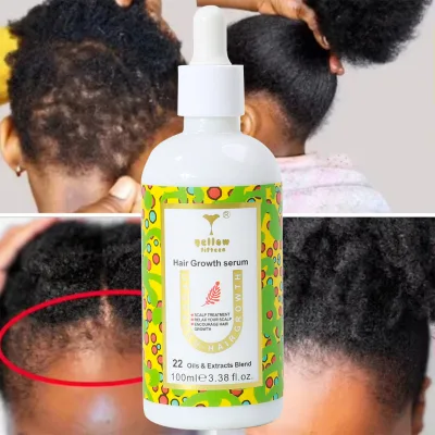 Miracle Hair Growth Oil Original Rosemary Oil Hair Growth Original Natural Hair Growth Serum for Black Women