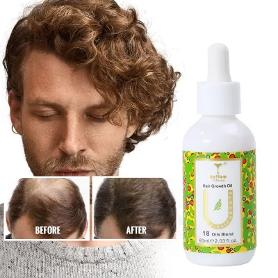 Custom Logo 60ml/100ml Rosemary Peppermint Biotin Hair Growth Serum Hair Growth  Oil Treatment for Regrowth