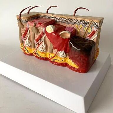 PVC Burn Skin Anatomical Model