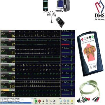 Cardiac Rehab-Cardiovision ECG Telemetry Real Time Monitoring System Wifi Transmitter Holter Monitor System