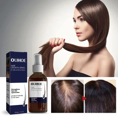 Wholesale Organic Vegan Herbal Nature Concentrated Formula Hair Repairing Fast Hair Growth Treatment Regrowth Oil Anti Hair Loss