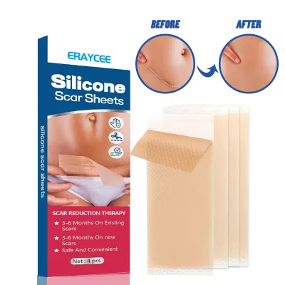 Silicon Gel Scar Repair Patch Reduce Scars, Pregnancy Surgery Scars Smooths Skin Care Beauty Patch