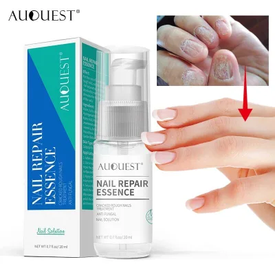 Nail Repair Serum Anti Fungal Foot Care Repair Onychomycosis Solution Priavte Label