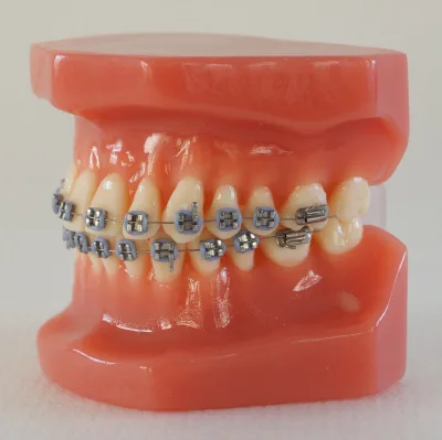 Dental Teeth Orth Orthodontic Models with Brackets