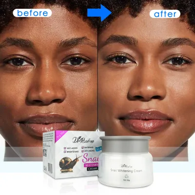 DR.ROSEVA ODM OEM Women Dvanced Snail 92 All in One Cream Snail Cream Hydrating Moisturizing Facial Cream