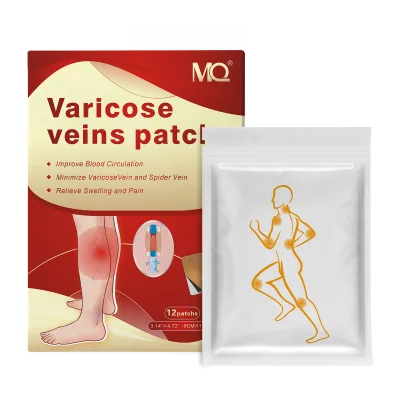 Varicose Vein Discomfort Temporary Relief for Swollen and Aching Legs Wholesale