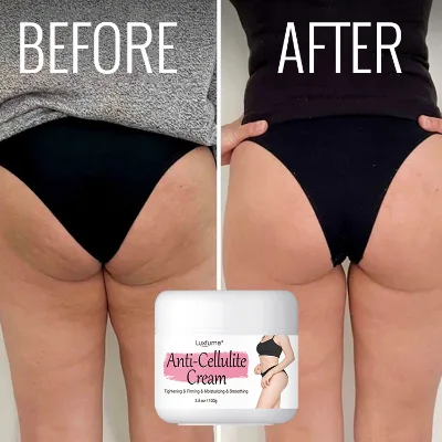 Reduce the Look of Cellulite Tightening Lifting Sagging Skin Anti Cellulite Cream