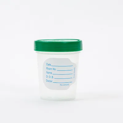 Amsino Lab test Specimen Container Disposable Sterile Histology Sample Specimen Containers Cup